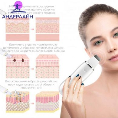 Ультразвуковий скрабер для чищення обличчя омолодження шкіри ліфтингу та фонофорезу Ultrasonic Scrubber W-1188