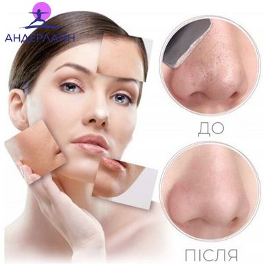Ультразвуковий скрабер для чищення обличчя омолодження шкіри ліфтингу та фонофорезу Ultrasonic Scrubber W-1188