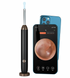 Умный отоскоп Tinsol Smart Visual Ear Cleaner 1296P с Wi-Fi и камерой