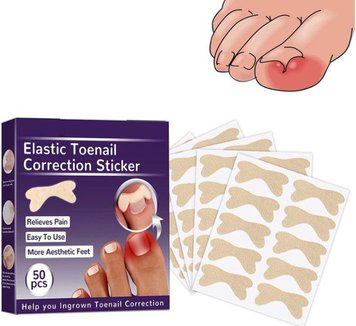 Набір пластирів Elastic Toenail Correction Sticker для корекції та усунення врослих нігтів (50 шт.)