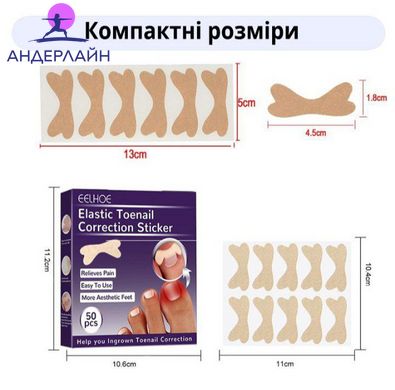 Набір пластирів Elastic Toenail Correction Sticker для корекції та усунення врослих нігтів (50 шт.)