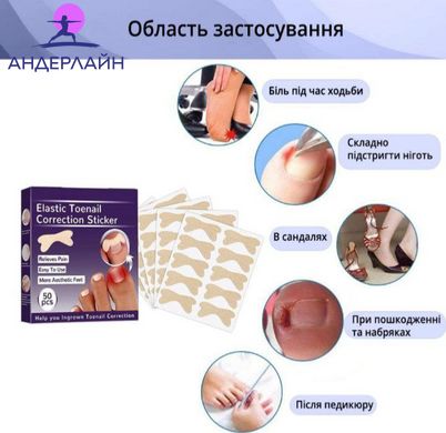 Набір пластирів Elastic Toenail Correction Sticker для корекції та усунення врослих нігтів (50 шт.)