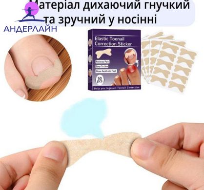 Набір пластирів Elastic Toenail Correction Sticker для корекції та усунення врослих нігтів (50 шт.)