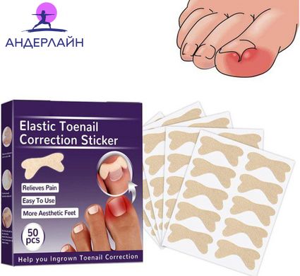 Набір пластирів Elastic Toenail Correction Sticker для корекції та усунення врослих нігтів (50 шт.)