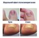 Набор пластырей Elastic Toenail Correction Sticker для коррекции и устранения вросших ногтей (50 шт.)